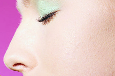 鼻子假体取出影响美观吗